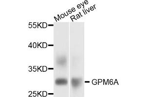Western blot analysis of extract of mouse eye and rat liver cells, using GPM6A antibody. (GPM6A Antikörper)