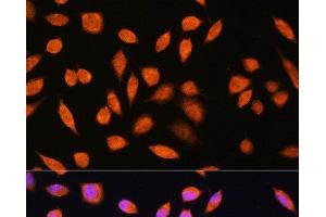 Immunofluorescence analysis of L929 cells using PNPO Polyclonal Antibody at dilution of 1:100. (PNPO Antikörper)