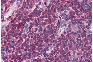 Human Thymus (formalin-fixed, paraffin-embedded) stained with MIF antibody ABIN337308 at 2. (MIF Antikörper  (AA 103-115))