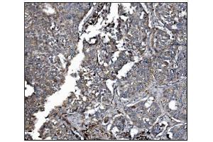 IHC analysis of LRP1B using anti-LRP1B antibody (ABIN7601521). (LRP1B Antikörper  (AA 3704-4547))