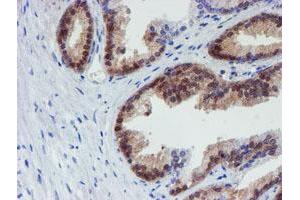 Image no. 1 for anti-Mannose Phosphate Isomerase (MPI) antibody (ABIN1499545) (MPI Antikörper)