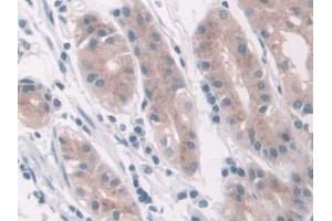 DAB staining on IHC-P; Samples: Human Stomach Tissue (LDHD Antikörper  (AA 62-265))