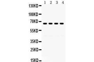 Western Blotting (WB) image for anti-G Protein-Coupled Receptor Kinase 6 (GRK6) (AA 382-417), (C-Term) antibody (ABIN3042435) (GRK6 Antikörper  (C-Term))