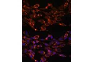 Immunofluorescence analysis of NIH/3T3 cells using Monoamine Oxidase A (Monoamine Oxidase A (MAOA)) antibody (ABIN3021915, ABIN3021916, ABIN3021917 and ABIN6217576) at dilution of 1:100. (Monoamine Oxidase A Antikörper  (AA 1-260))