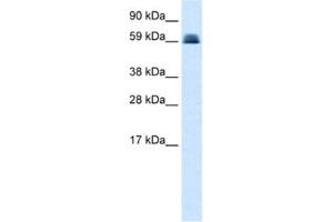 Western Blotting (WB) image for anti-Zinc Finger and BTB Domain Containing 45 (ZBTB45) antibody (ABIN2460150) (ZBTB45 Antikörper)
