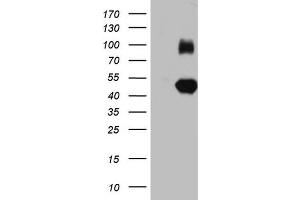 Western Blotting (WB) image for anti-Immunoglobulin Superfamily, Member 11 (IGSF11) (AA 23-241) antibody (ABIN2674593) (IGSF11 Antikörper  (AA 23-241))