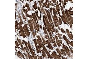 Immunohistochemical staining of human heart muscle with FAM26E polyclonal antibody  shows strong cytoplasmic and membranous positivity in myocytes at 1:500-1:1000 dilution. (FAM26E Antikörper)