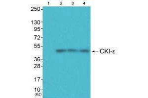 CK1 epsilon anticorps