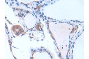 Detection of GbL in Human Thyroid Tissue using Polyclonal Antibody to G Protein Beta Subunit Like Protein (GbL) (GNB1L Antikörper  (AA 69-247))