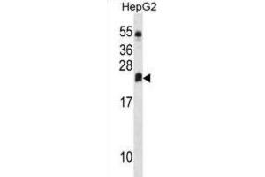 Western Blotting (WB) image for anti-Dehydrogenase/reductase (SDR Family) Member 4 Like 2 (DHRS4L2) antibody (ABIN3000211) (DHRS4L2 Antikörper)