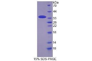 Image no. 1 for Keratocan (KERA) (AA 21-292) protein (His tag) (ABIN6238593) (KERA Protein (AA 21-292) (His tag))
