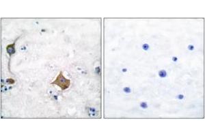 Immunohistochemistry analysis of paraffin-embedded human brain tissue, using Synaptophysin Antibody. (Synaptophysin Antikörper  (AA 101-150))