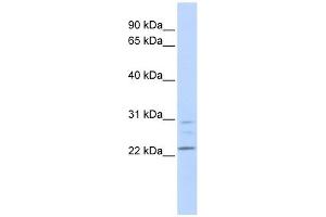LYPLA1 antibody used at 1 ug/ml to detect target protein. (LYPLA1 Antikörper  (Middle Region))