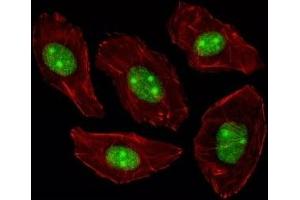 Fluorescent image of A549 cells stained with NPM1 antibody. (NPM1 Antikörper  (AA 198-226))