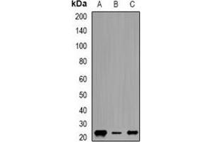 Western blot analysis of Geminin expression in HepG2 (A), MCF7 (B), K562 (C) whole cell lysates. (Geminin Antikörper)