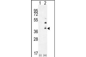 Western blot analysis of TNFSF15 (arrow) using rabbit polyclonal TNFSF15 Antibody (Center) (ABIN655822 and ABIN2845246). (TNFSF15 Antikörper  (AA 148-175))