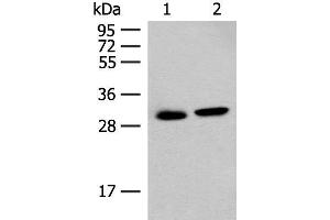 Western blot analysis of Mouse kidney tissue and Human kidney tissue lysates using GLYAT Polyclonal Antibody at dilution of 1:300 (GLYAT Antikörper)