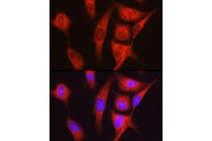 Immunofluorescence analysis of U2OS cells using S6 Ribosomal Protein (RPS6) Rabbit pAb (ABIN6133901, ABIN6147227, ABIN6147228 and ABIN6221687) at dilution of 1:100 (40x lens). (RPS6 Antikörper  (AA 1-100))