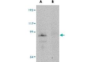 Western blot analysis of JPH4 in mouse brain tissue lysate with JPH4 polyclonal antibody  at 1 ug/mL in (A) the absence and (B) the presence of blocking peptide. (Junctophilin 4 Antikörper  (Internal Region))