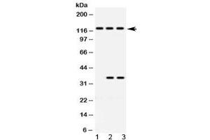 Western blot testing of 1) rat brain, 2) human HeLa and 3) human Jurkat lysate with ARHGEF1 antibody at 0. (ARHGEF1 Antikörper  (AA 41-71))