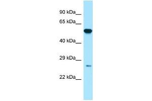 Host:  Rabbit  Target Name:  GSTP1  Sample Type:  Placenta lysates  Antibody Dilution:  1.