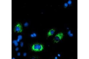 Anti-AGPAT5 mouse monoclonal antibody (ABIN2455450) immunofluorescent staining of COS7 cells transiently transfected by pCMV6-ENTRY AGPAT5 (RC210280). (AGPAT5 Antikörper)