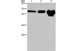 Western Blot analysis of 823 cell, Mouse brain and Human fetal brain tissue using MMP20 Polyclonal Antibody at dilution of 1:400 (MMP20 Antikörper)
