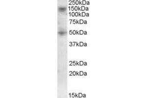 Image no. 1 for anti-Ring Finger Protein 139 (RNF139) (AA 651-663) antibody (ABIN1492761) (RNF139 Antikörper  (AA 651-663))