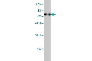 Western Blot detection against Immunogen (74. (Fatty Acid Synthase Antikörper  (AA 1-439))