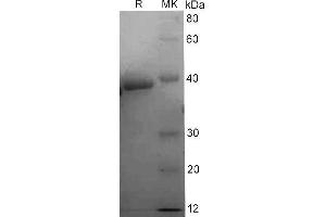 Western Blotting (WB) image for Arginase, Liver (ARG1) protein (His tag) (ABIN7319955) (Liver Arginase Protein (His tag))
