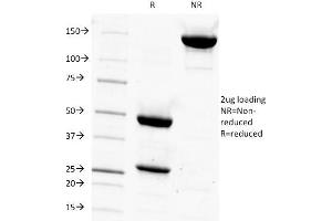 SDS-PAGE Analysis Purified PSA Mouse Monoclonal Antibody (1A7). (Prostate Specific Antigen Antikörper)