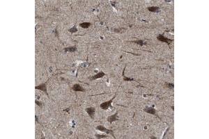 Immunohistochemical staining of human cerebral cortex with SLC35F1 polyclonal antibody  shows strong cytoplasmic positivity in neuronal cells at 1:500-1:1000 dilution. (SLC35F1 Antikörper)