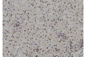 ABIN6277593 at 1/100 staining Human liver tissue by IHC-P.