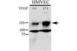 Phospho-KDR antibody used in western blot to detect phosphorylated KDR/FLK1 in HMVEC lysate. (VEGFR2/CD309 Antikörper  (pTyr996))