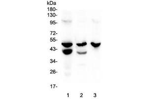 Western blot testing of 1) rat stomach, 2) mouse stomach and 3) mouse SP2/0 lysate with Cathepsin E antibody at 0. (Cathepsin E Antikörper  (AA 150-393))