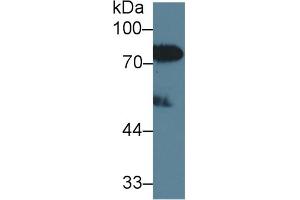Detection of LBP in Human Serum using Polyclonal Antibody to Lipopolysaccharide Binding Protein (LBP) (LBP Antikörper  (AA 27-481))