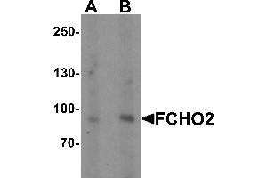 Western blot analysis of FCHO2 in rat heart tissue lysate with FCHO2 antibody at (A) 1 and (B) 2 µg/mL (FCHO2 Antikörper  (Middle Region))
