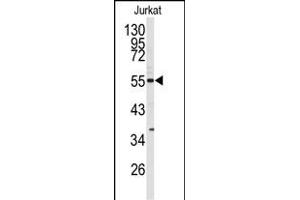 Western blot analysis of CDK8 antibody (N-term) (ABIN391759 and ABIN2841626) in Jurkat cell line lysates (35 μg/lane). (CDK8 Antikörper  (N-Term))