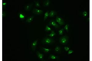 Immunofluorescence staining of A549 cells with ABIN7127704 at 1:100,counter-stained with DAPI. (Rekombinanter C-JUN Antikörper  (pSer63))