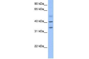 WB Suggested Anti-ZC3H14 Antibody Titration: 0. (ZC3H14 Antikörper  (N-Term))