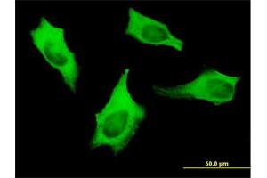 Immunofluorescence of monoclonal antibody to MYH9 on HeLa cell. (Myosin 9 Antikörper  (AA 131-220))