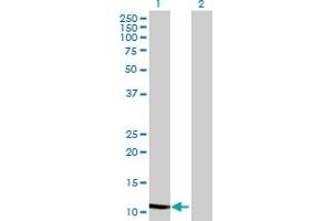 Western Blot analysis of WFDC5 expression in transfected 293T cell line by WFDC5 MaxPab polyclonal antibody.