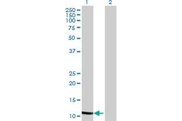 WFDC5 anticorps  (AA 1-123)