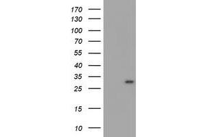 Image no. 1 for anti-Myeloid Leukemia Factor 1 (MLF1) antibody (ABIN1499497)