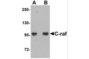 Western Blotting (WB) image for anti-V-Raf-1 Murine Leukemia Viral Oncogene Homolog 1 (RAF1) (N-Term) antibody (ABIN781705) (RAF1 Antikörper  (N-Term))