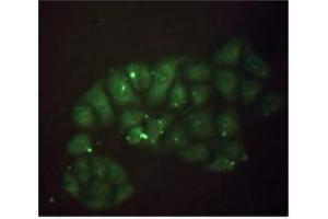 Stainning of methanol-fixed Hela cells: Mouse anti-Human beta 2 Microglobulin monoclonal antibody (D2A10) 1/50 (20 µg/ml). (beta-2 Microglobulin Antikörper)
