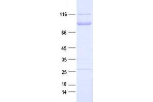 Validation with Western Blot