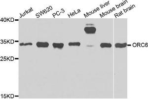 Western blot analysis of extracts of various cells, using ORC6 antibody. (ORC6 Antikörper)