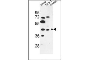 Western blot analysis of PSG3 Antibody (N-term) in MCF-7 cell line and Mouse liver, brain tissue lysates (35ug/lane). (PSG3 Antikörper  (N-Term))