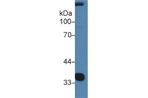 Western Blot; Sample: Rat Serum; Primary Ab: 2µg/ml Rabbit Anti-Rat NOV Antibody Second Ab: 0. (NOV Antikörper  (AA 156-351))